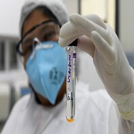 Com pr&aacute;tica inovadora, Lacen passar&aacute; a fazer sequenciamento gen&ocirc;mico da turberculose em MS