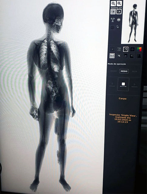Policiais penais flagram visitante com droga escondida no corpo