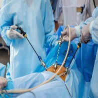 SES amplia acesso &agrave; cirurgia bari&aacute;trica em MS com triagem criteriosa e novas refer&ecirc;ncias