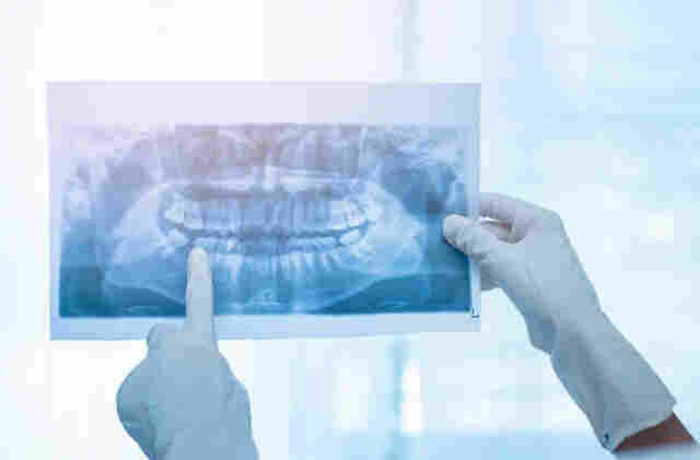SES auxilia na compra de raio-X panor&acirc;mico para equipar Corumb&aacute; e munic&iacute;pios com estrutura odontol&oacute;gica avan&ccedil;ada