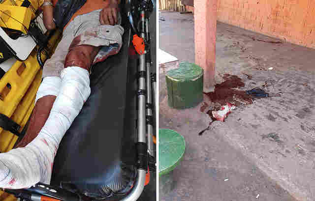 Homem &eacute; atacado por c&atilde;es da ra&ccedil;a pitbull no conjunto Flamboyant em Corumb&aacute;
