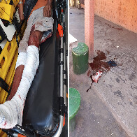 Homem &eacute; atacado por c&atilde;es da ra&ccedil;a pitbull no conjunto Flamboyant em Corumb&aacute;