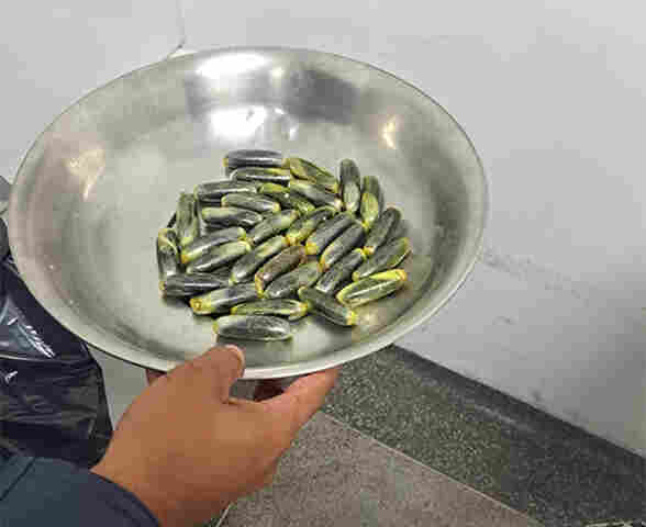 Boliviano procura UPA de Corumb&aacute; com dores abdominais e m&eacute;dico aciona PM ap&oacute;s raio-x constatar c&aacute;psulas de drogas