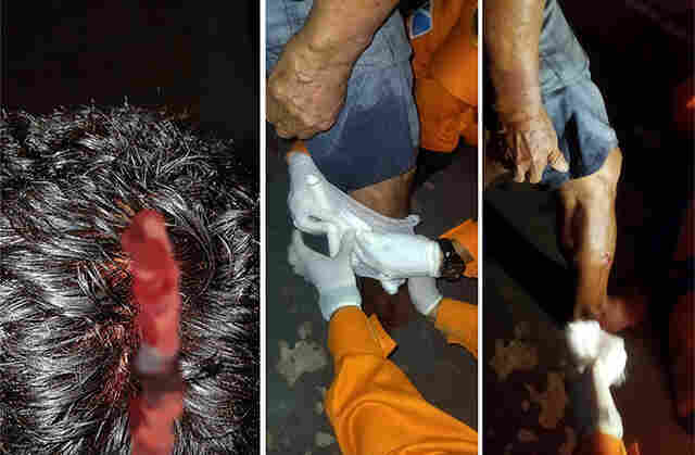 Idoso &eacute; atacado por pitbull quando caminhava pelo Centro de Corumb&aacute;
