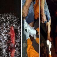 Idoso &eacute; atacado por pitbull quando caminhava pelo Centro de Corumb&aacute;