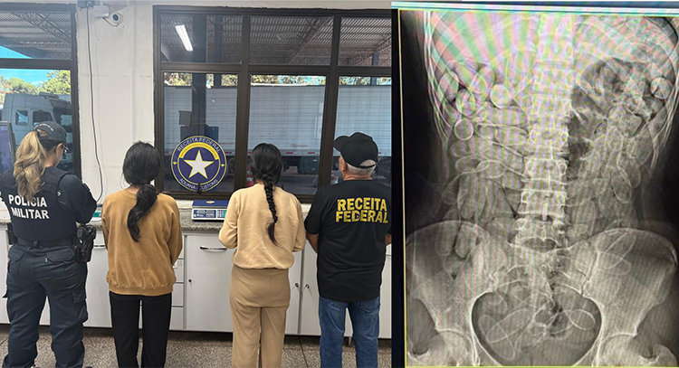 Bolivianas s&atilde;o detidas na fronteira ap&oacute;s ter n&aacute;useas e expelir c&aacute;psula de coca&iacute;na 