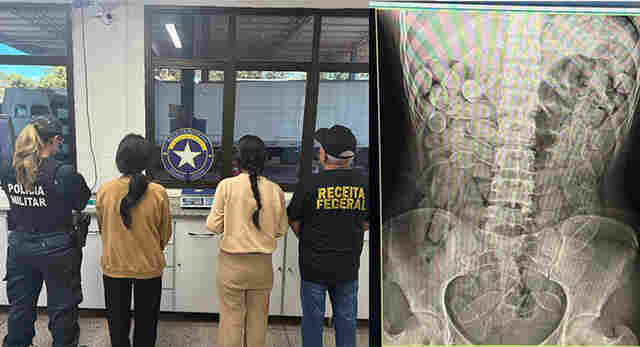 Bolivianas s&atilde;o detidas na fronteira ap&oacute;s ter n&aacute;useas e expelir c&aacute;psula de coca&iacute;na 