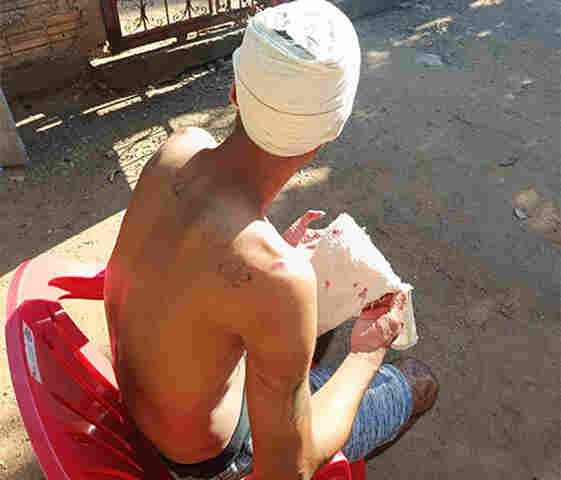 Bebedeira em bar no bairro Cristo Redentor termina com homem agredido por dois indiv&iacute;duos 
